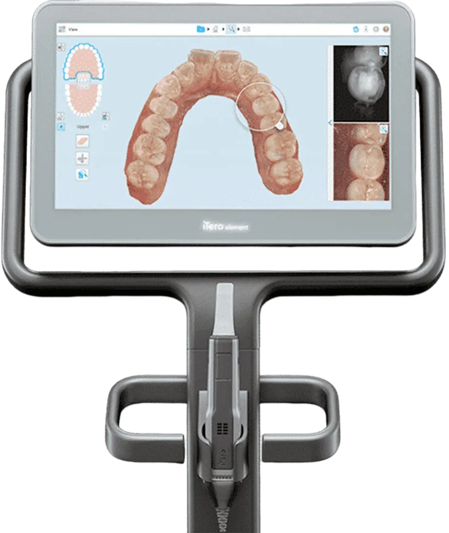 Aparelho Scanner Itero